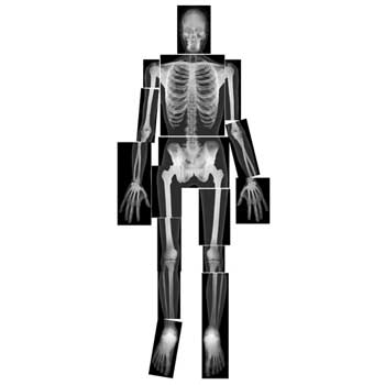 Roylco X-Rays, True to Life Human